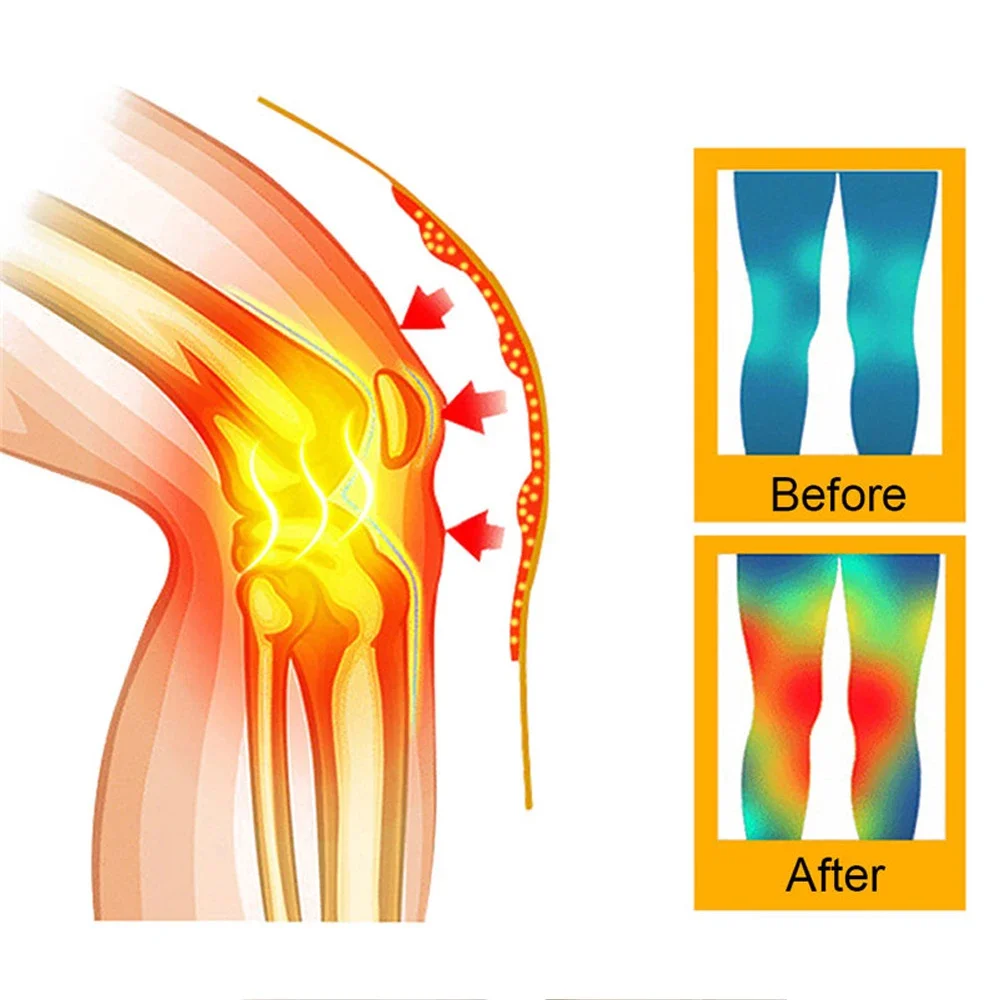 Mugwort Knee Pads Self-Heating - Running Gear In The Cold 评论和价格